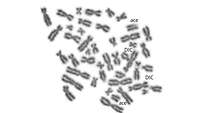 Analyse dizentrischer Chromosomen