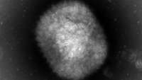 Mikroskopaufnahme eines Virus