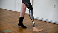 Ein Mann trägt eine Beinprothese und geht über einen Flur