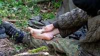 A soldier's foot with blisters on the heel and the sole.